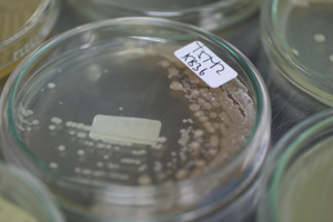 Análisis microbiológico de suelos (bacterias, hongos y actinomicetos)